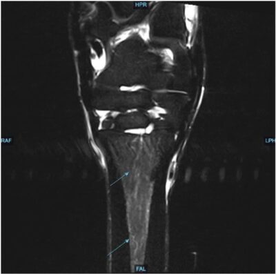 Equine Imaging and Rehabilitation