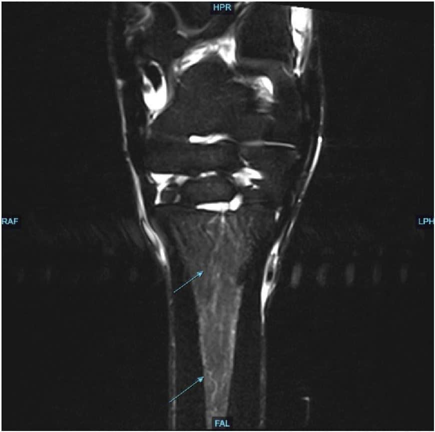 Equine Imaging and Rehabilitation – Animal Imaging