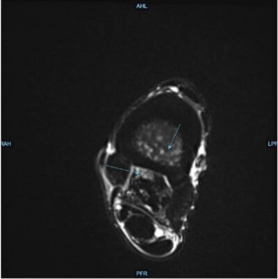 Equine Imaging and Rehabilitation