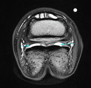 Equine MRI