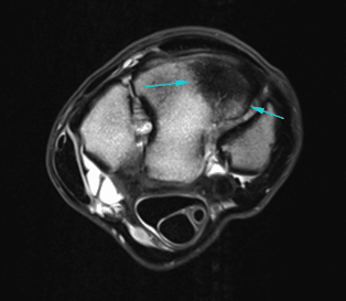 Equine MRI