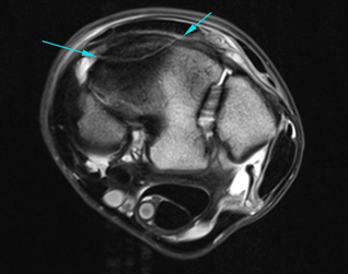 Equine MRI