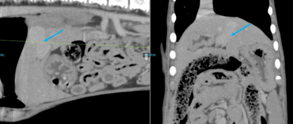 Canine CT Shunt Study