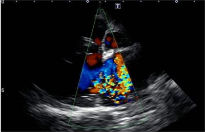 Canine Echocardiogram