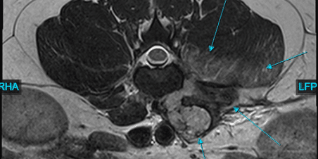 canineMRI3