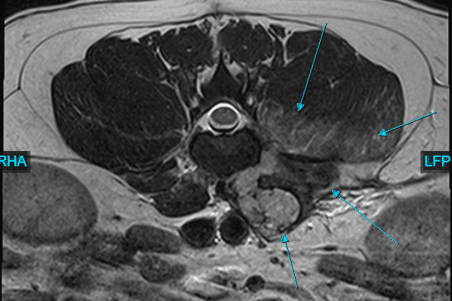 canineMRI3