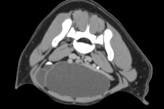 case study ct 6